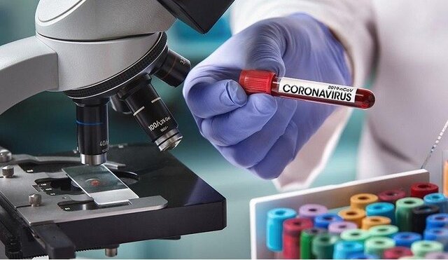 تولید کیتتشخیصی در فاز آزمایشی/انجام مطالعه روی داروی چینی و ژاپنی مؤثر بر کرونا تولید کیتتشخیصی در فاز آزمایشی/انجام مطالعه روی داروی چینی و ژاپنی مؤثر بر کرونا