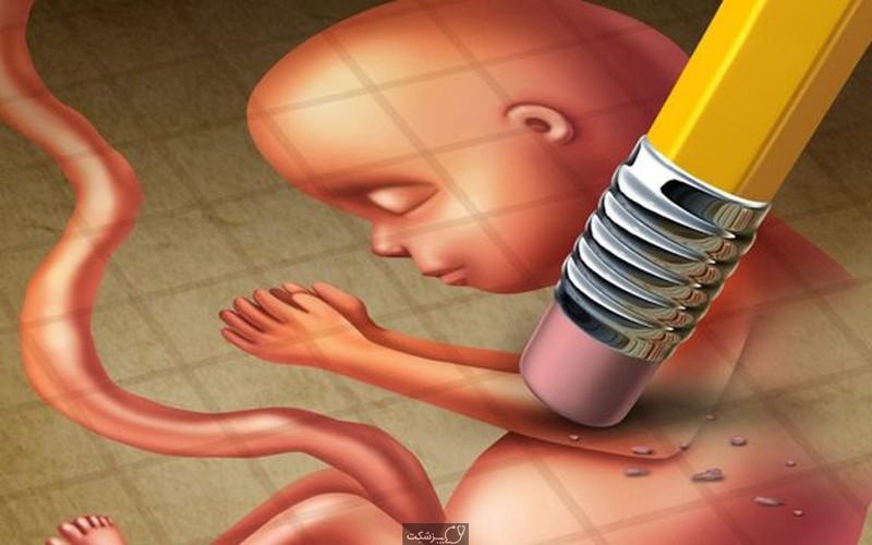 سقط جنین عمدی چه بلایی سر مادر می آورد؟ سقط جنین عمدی چه بلایی سر مادر می آورد؟