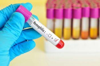 کودکان هموفیلی مبتلا به هپاتیت سی با آلفا اینترفرون درمان می شوند؟