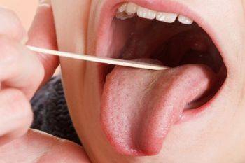 علت خشکی دهان چیست؟