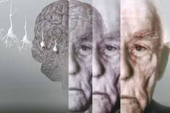   علائم دیگر آلزایمر غیر از فراموشی را بدانیم.
