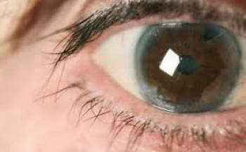آسیب دیدن  بینایی با بیماری آب مروارید 