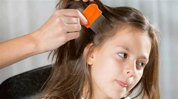 بهترین راه برای درمان شپش موی کودکان