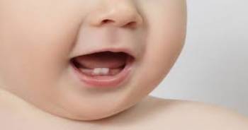 راه های مراقبت از دندانهای شیری کودک