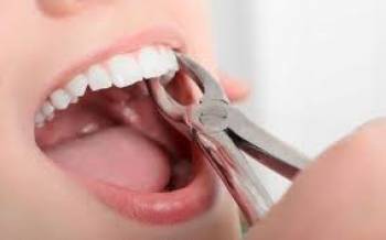 چرا دچار نکروز دندان می‌شویم؟