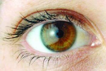 درمان میگرن چشمی